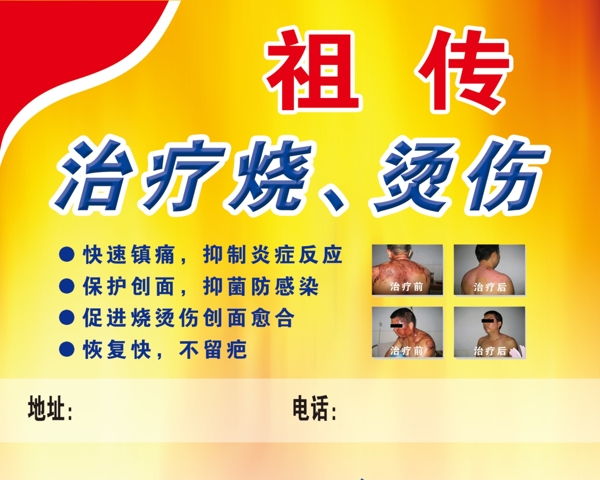 祖?zhèn)髦委煙隣C傷圖片
