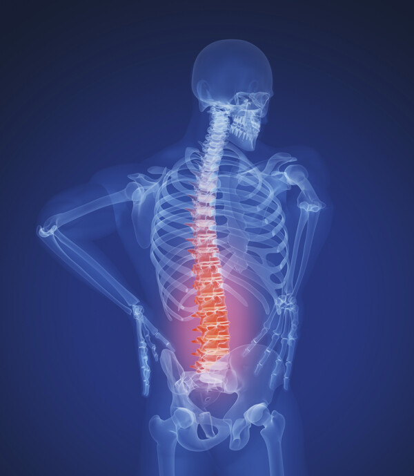 人体脊椎X光图像图片