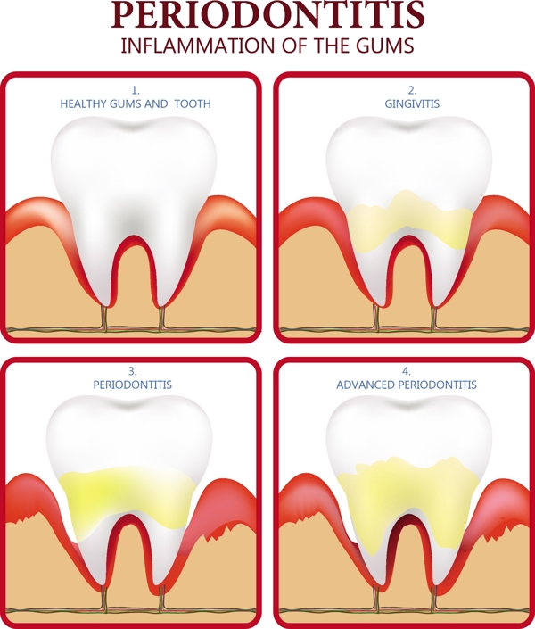 牙周病海报平面彩色设计齿图标免费矢量