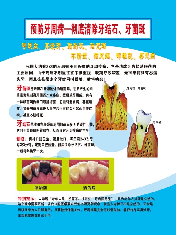牙结石牙菌斑图片