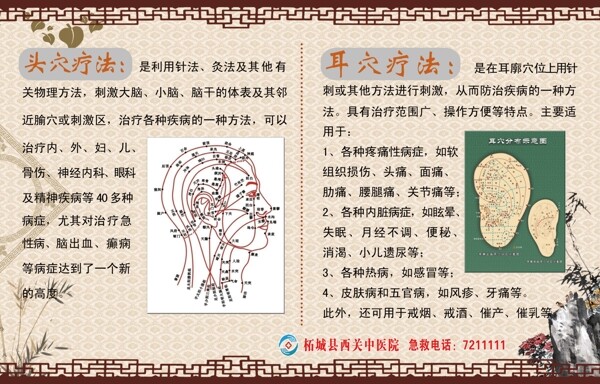 頭穴治療展板圖片