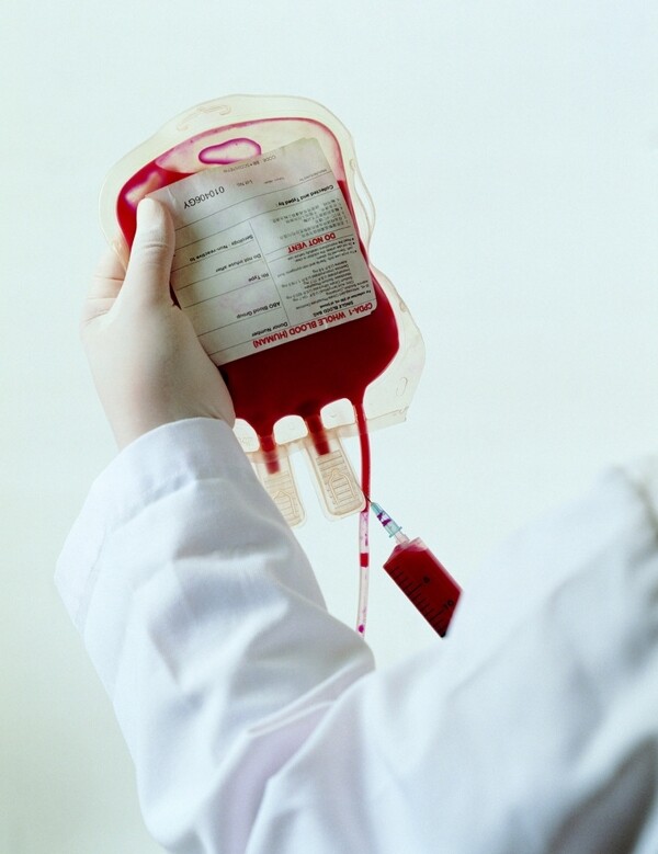 血浆图片