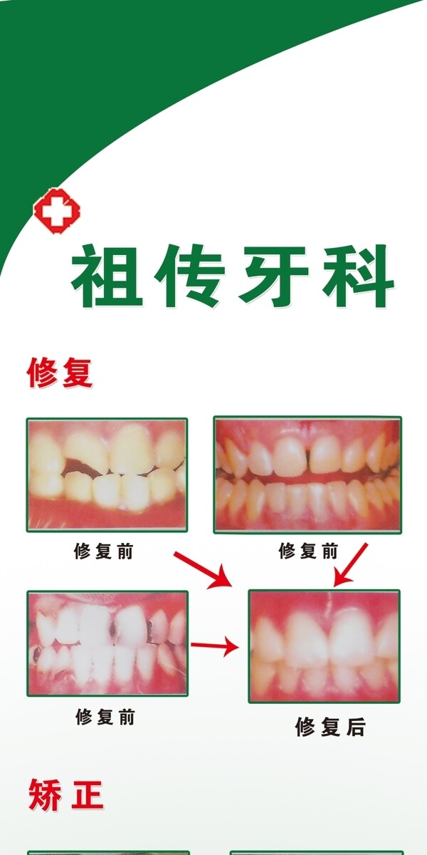 牙科展板图片