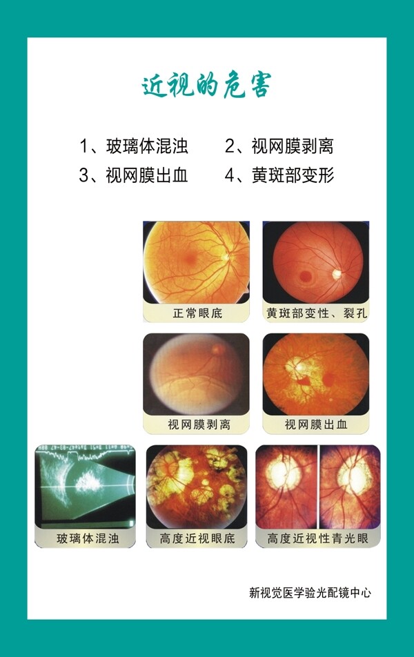 眼科图片