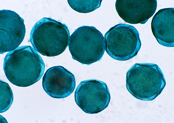 深蓝色球形细胞