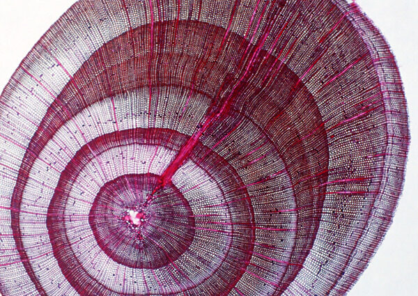 螺纹状细胞结晶
