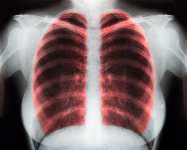心肺器官图片