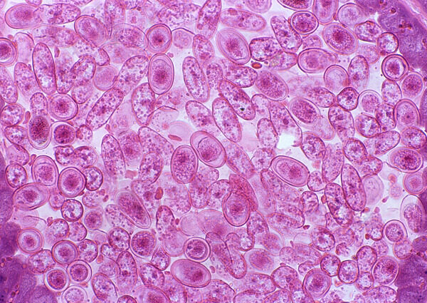紫色微型细胞结晶体