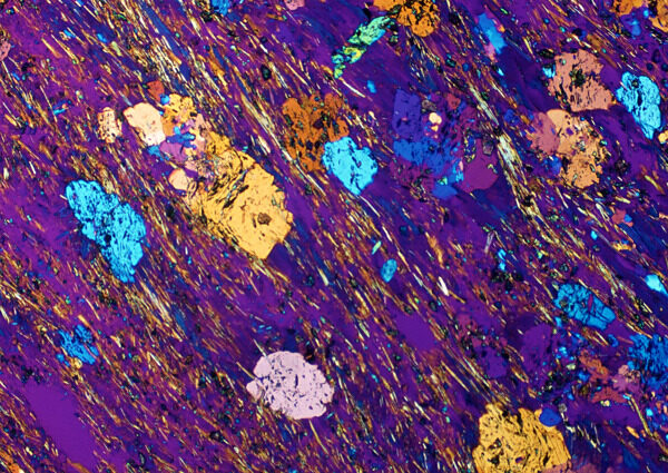 紫色斑点细胞