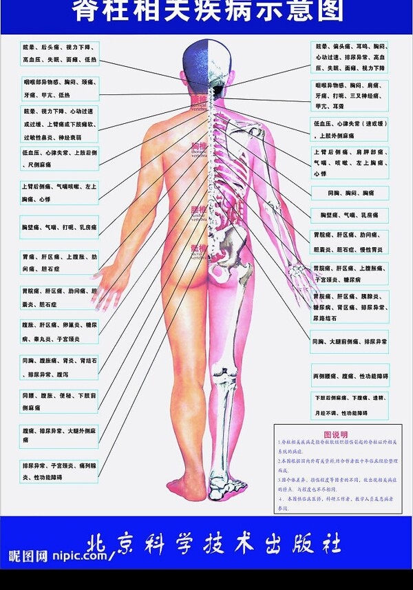 脊柱相关疾病示意图图片